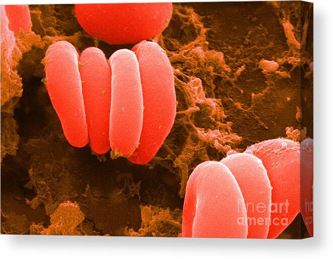 Biology Canvas Print featuring the photograph Red Blood Cells, Rouleaux Formation, Sem by Science Source
