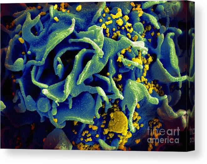 Microbiology Canvas Print featuring the photograph Hiv-infected T Cell, Sem by Science Source