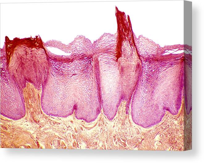 Muscle Canvas Print featuring the photograph Tongue Papillae, Light Micrograph by Steve Gschmeissner
