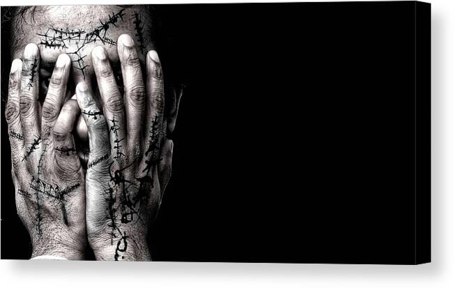 Accident Canvas Print featuring the photograph Scars by Venura Herath