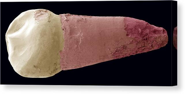Milk Tooth Canvas Print featuring the photograph Human Canine Milk Tooth, Sem by Steve Gschmeissner
