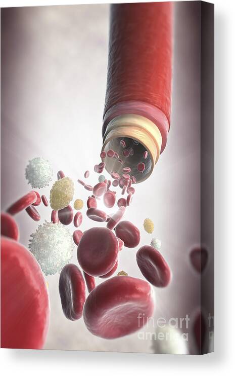 Blood Vessel Canvas Print featuring the photograph Blood Vessel With Cells #8 by Science Picture Co