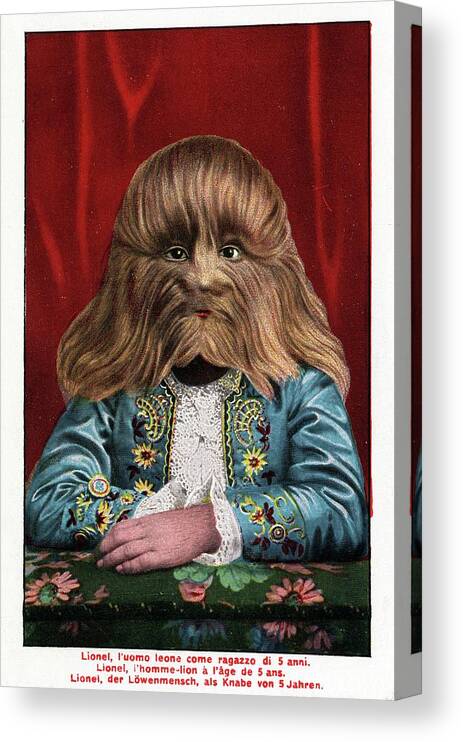 Lionel Canvas Print featuring the photograph Boy With Hypertrichosis by American Philosophical Society