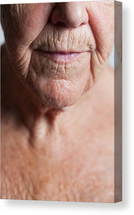 Mouth Canvas Print featuring the photograph Elderly Woman's Lower Face And Upper Chest by Cristina Pedrazzini/science Photo Library