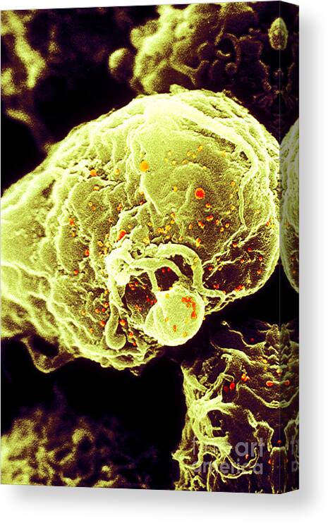 Medical Canvas Print featuring the photograph Hiv-1 Infected T4 Lymphocyte Sem #2 by Science Source