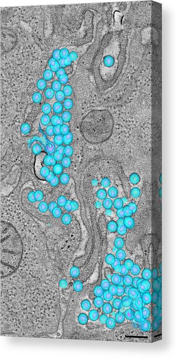 Science Canvas Print featuring the photograph Hiv-1 Virus In Colon by Science Source
