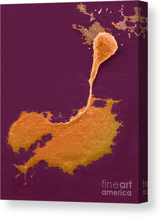 Science Canvas Print featuring the photograph Nerve Cell With Axon And Growth Cone #1 by Science Source