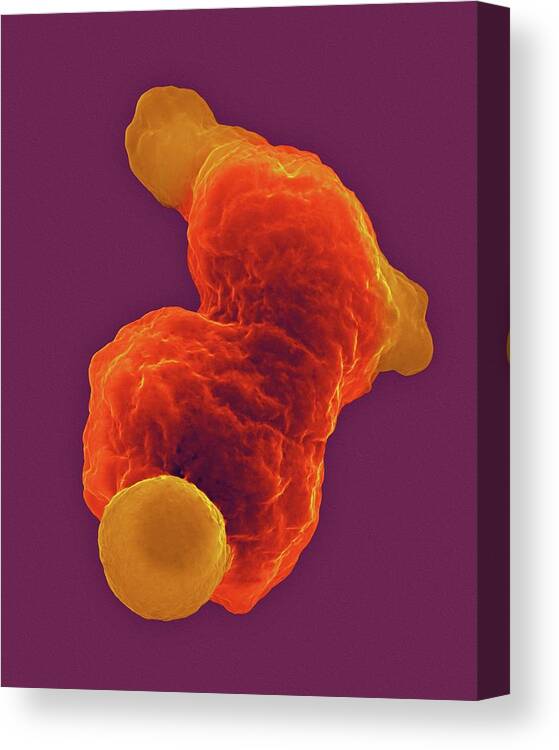 29239d Canvas Print featuring the photograph Parasitic Amoeba (entamoeba Gingivalis) Sem #1 by Dennis Kunkel Microscopy/science Photo Library