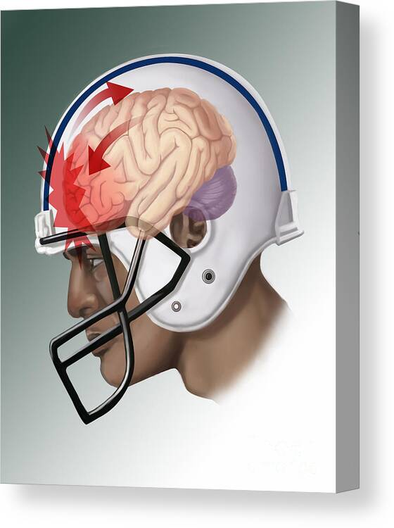 Science Canvas Print featuring the photograph Concussion #2 by Spencer Sutton