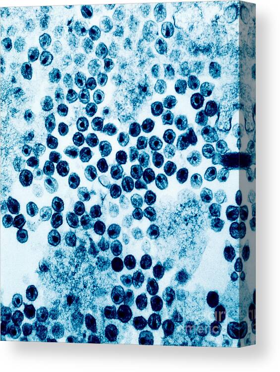Aids Canvas Print featuring the photograph Hiv Virus #2 by David M. Phillips