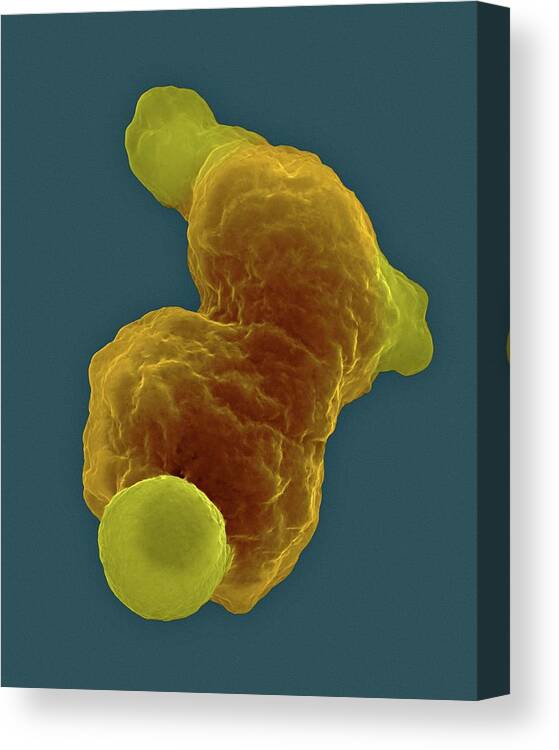 29239b Canvas Print featuring the photograph Parasitic Amoeba (entamoeba Gingivalis) Sem #2 by Dennis Kunkel Microscopy/science Photo Library
