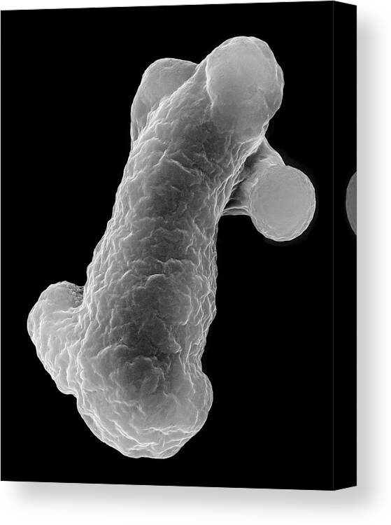 21060b Canvas Print featuring the photograph Parasitic Amoeba (entamoeba Histolytica) #3 by Dennis Kunkel Microscopy/science Photo Library
