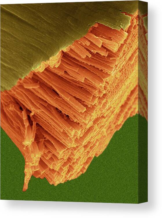 20638f Canvas Print featuring the photograph Skeletal Muscle Actin Myosin Filaments #5 by Dennis Kunkel Microscopy/science Photo Library
