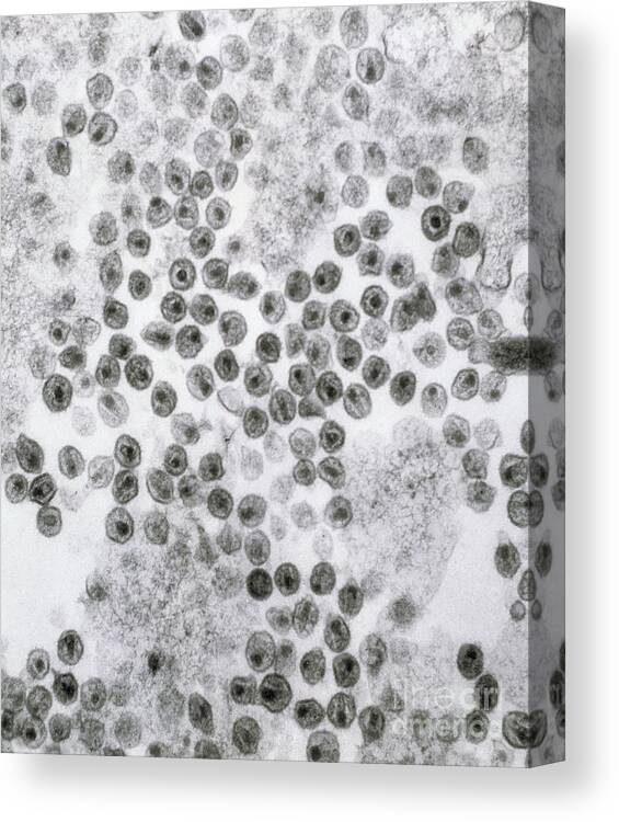 Hiv Canvas Print featuring the photograph Hiv Virus by David M. Phillips