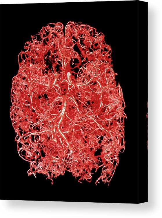 Human Body Canvas Print featuring the photograph Resin Cast Of Blood Supply To The Brain by Science Photo Library