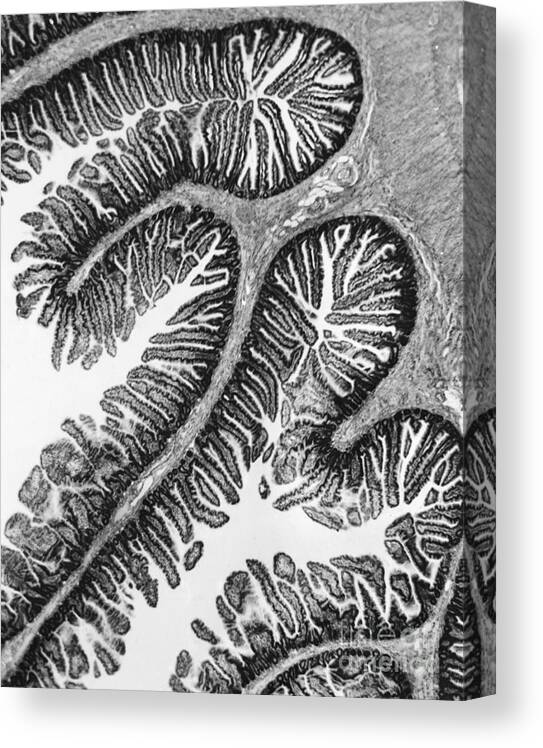 Cell Canvas Print featuring the photograph Tem Of Intestines Villi #2 by Science Source