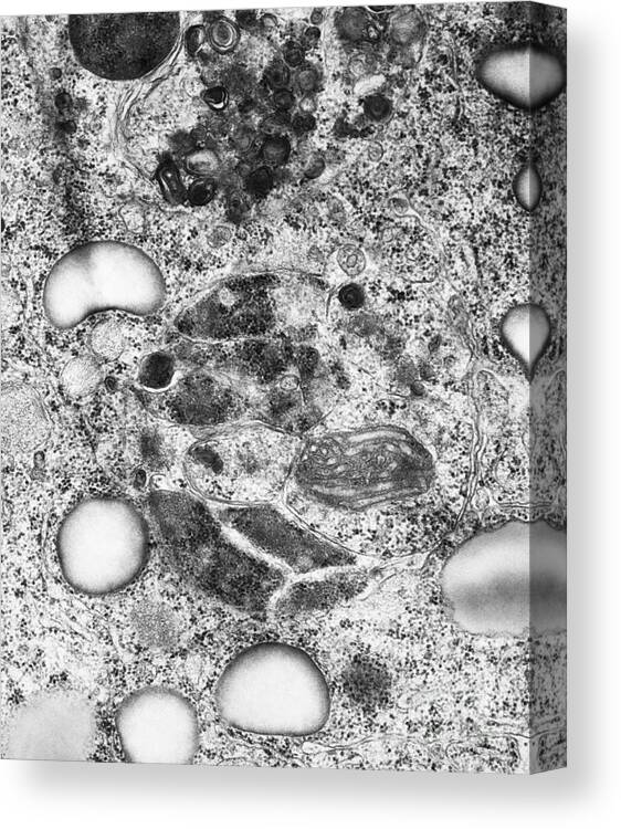 Eukaryote Canvas Print featuring the photograph Lysosomes, Tem by Science Source