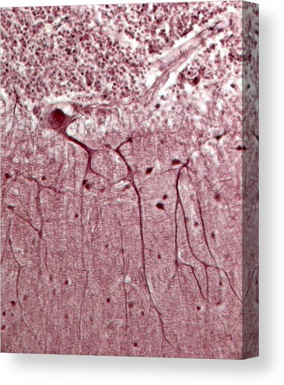 Purkinje Cell Canvas Print featuring the photograph Purkinje Neurons, Light Micrograph by Robert Markus