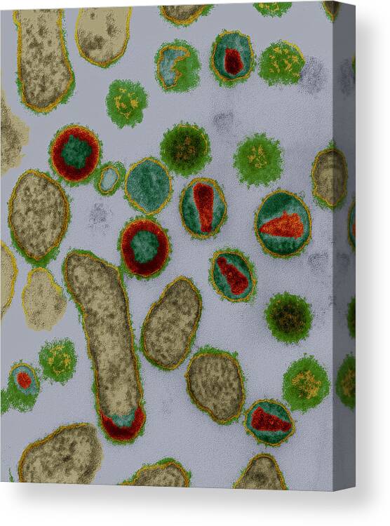 Acquired Immune Deficiency Syndrome Canvas Print featuring the photograph Hiv Viruses #2 by Meckes/ottawa