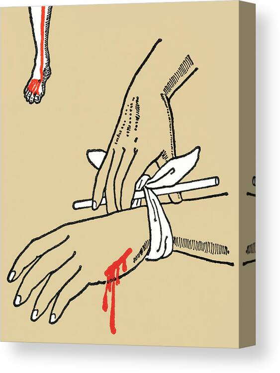 Accident Canvas Print featuring the drawing Injured hand by CSA Images