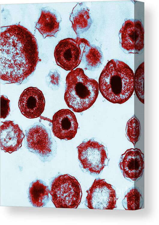 Medical Canvas Print featuring the photograph Chlamydia, Lm #1 by David M. Phillips