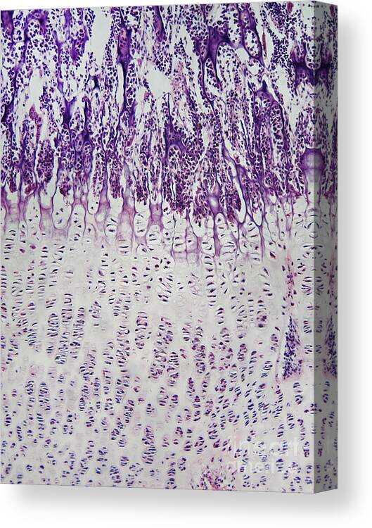 Light Micrograph Canvas Print featuring the photograph Ossification In Kittens Knee Joint #1 by Garry DeLong