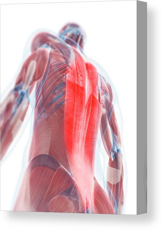 Physiology Canvas Print featuring the digital art Back Pain, Conceptual Artwork #48 by Sciepro