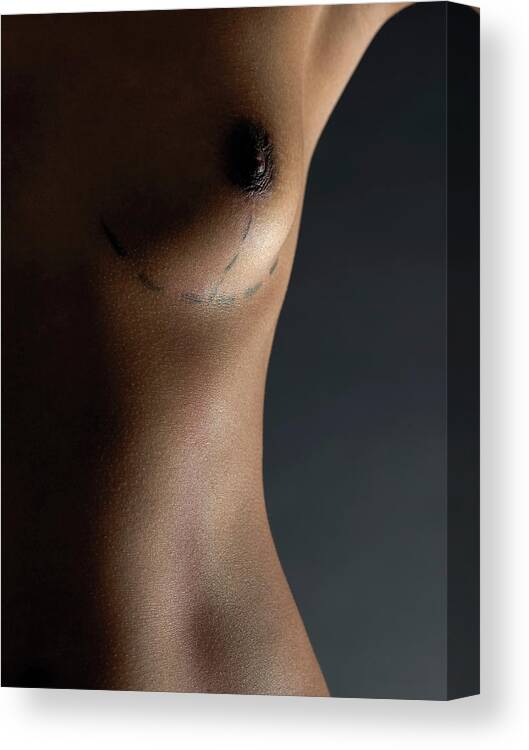 Line Canvas Print featuring the photograph Cosmetic Surgery #5 by Kate Jacobs/science Photo Library