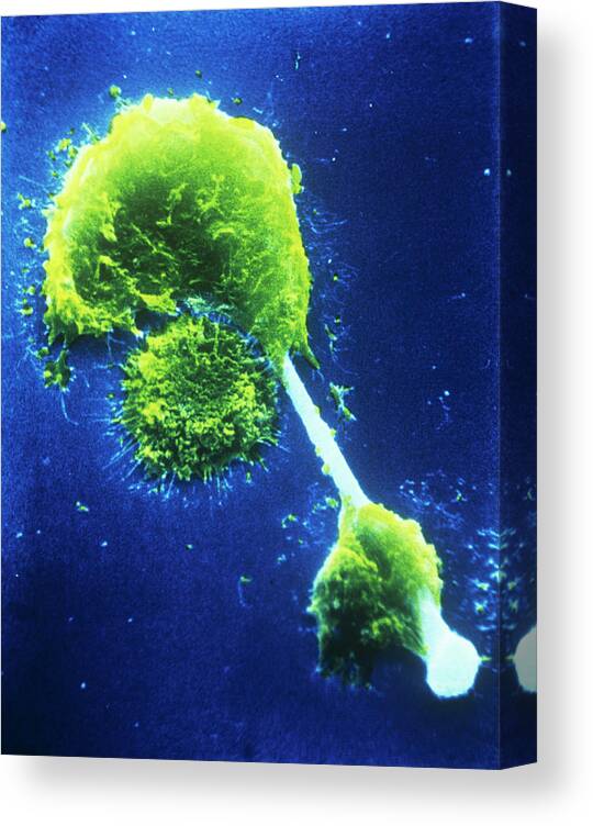 Magnified Image Canvas Print featuring the photograph Sem Of Macrophages Impaled On An Asbestos Needle by Photo Insolite Realite/science Photo Library