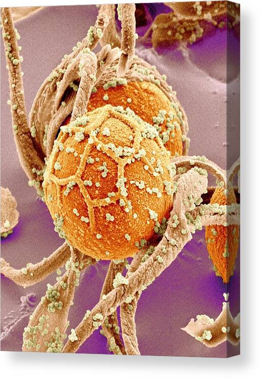 Horsetail Canvas Print featuring the photograph Horsetail Spores, Sem #2 by Susumu Nishinaga
