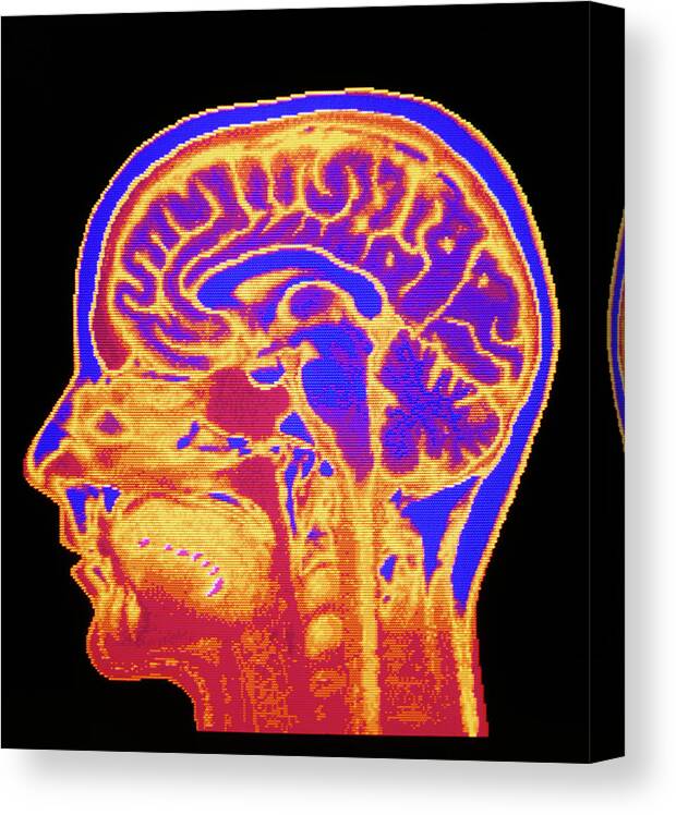 People Person Persons Canvas Print featuring the photograph Mri Scan Of Normal Brain #2 by Mehau Kulyk