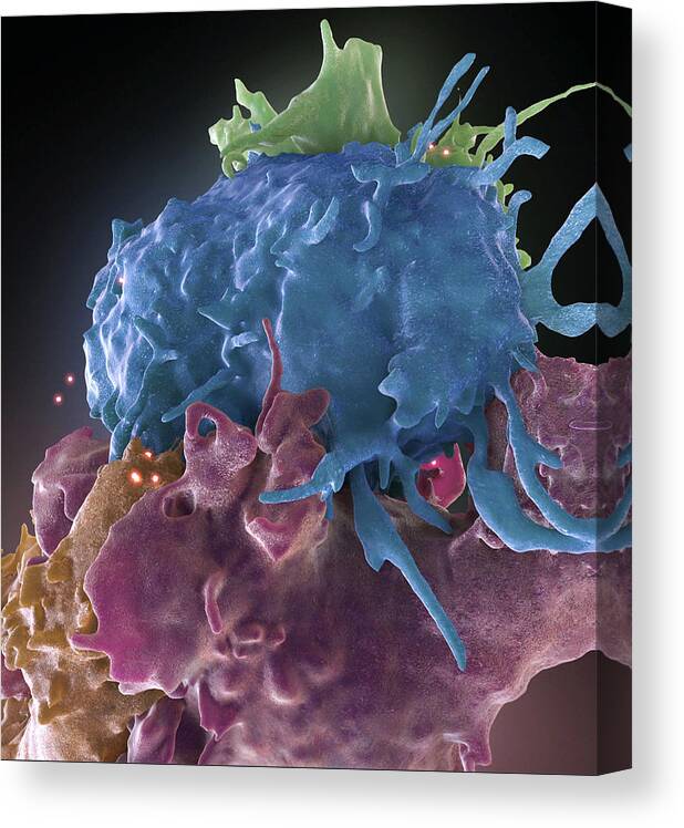 Science Canvas Print featuring the photograph Hiv-infected And Normal T Cells by Science Source