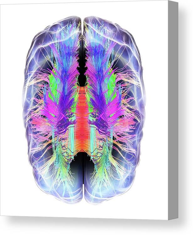 Brain Canvas Print featuring the photograph White Matter Fibres And Brain by Alfred Pasieka