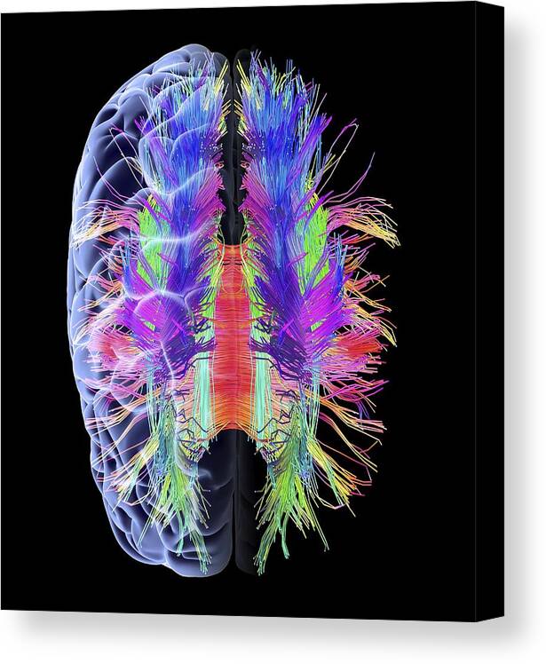 Brain Canvas Print featuring the photograph White matter fibres and brain, artwork by Science Photo Library