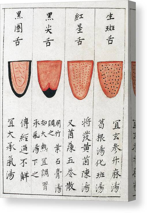 Chinese Tongue Chart