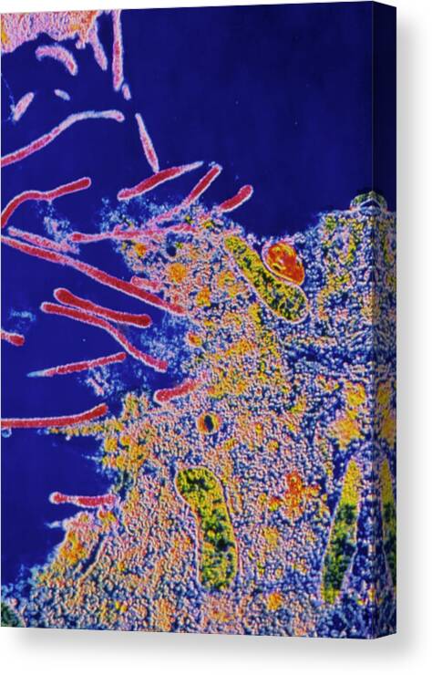 Mycoplasma Sp. Canvas Print featuring the photograph Mycoplasma Sp. Bacteria Infect Cell by Cnri/science Photo Library