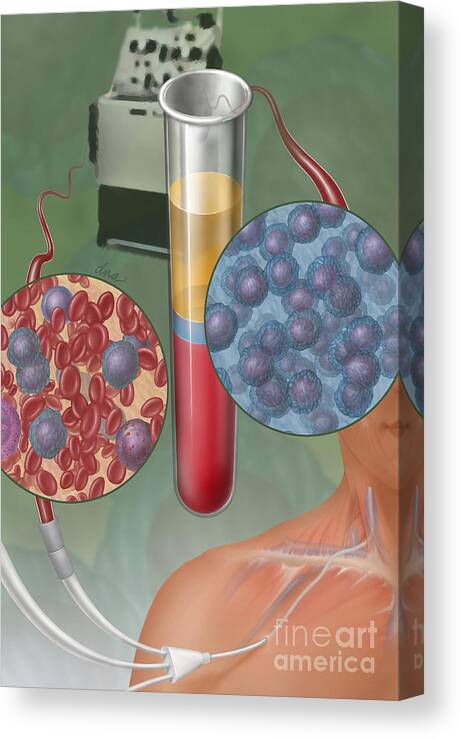 Stem Cell Transplantation Canvas Print featuring the photograph Stem Cell Transplantation, Illustration by DNA Illustrations