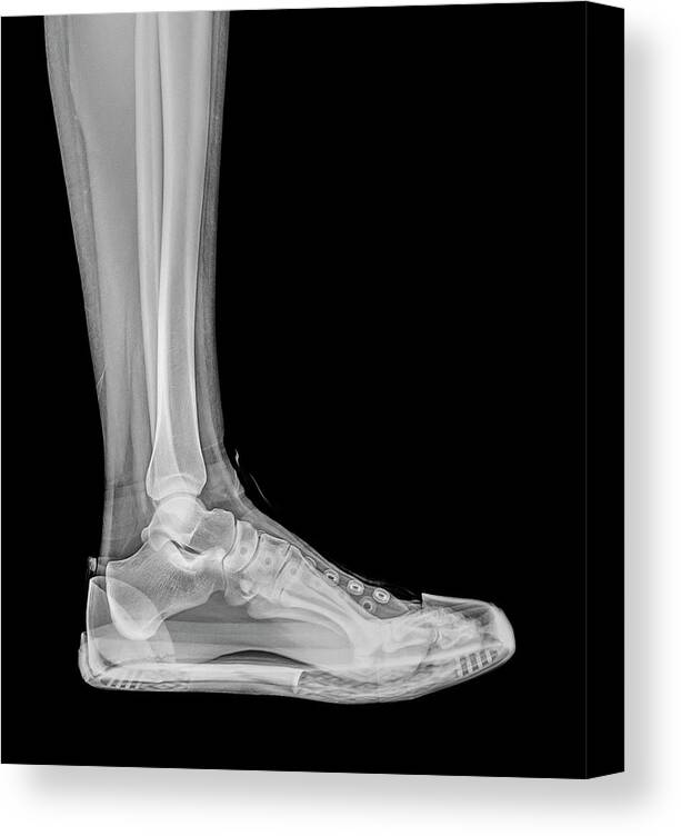 Adult Canvas Print featuring the photograph Trainers X-ray #1 by Photostock-israel