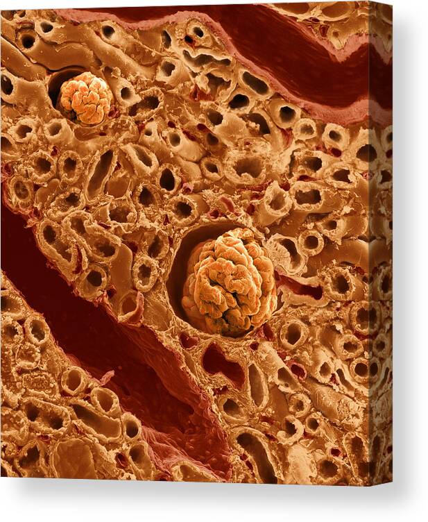Adrenal Gland Canvas Print featuring the photograph Kidney Cross Section, Sem by Anatomical Travelogue