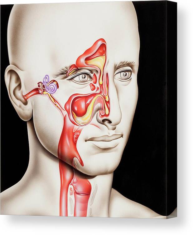 Sinusitis Canvas Print featuring the photograph Upper Respiratory Tract Infections by John Bavosi