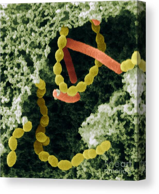Bacteria Canvas Print featuring the photograph Bacteria In Yogurt by Scimat