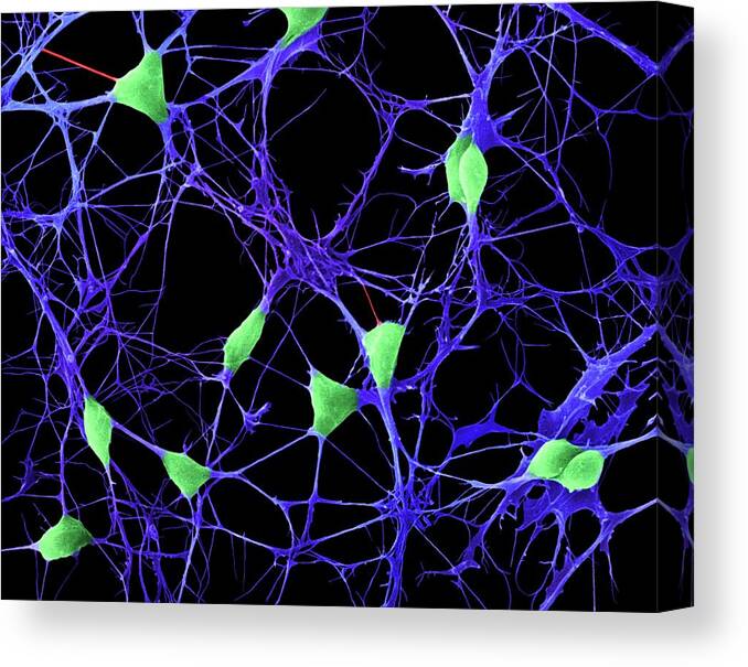 Central Nervous System Canvas Print featuring the photograph Cortical Neurons by Dennis Kunkel Microscopy/science Photo Library