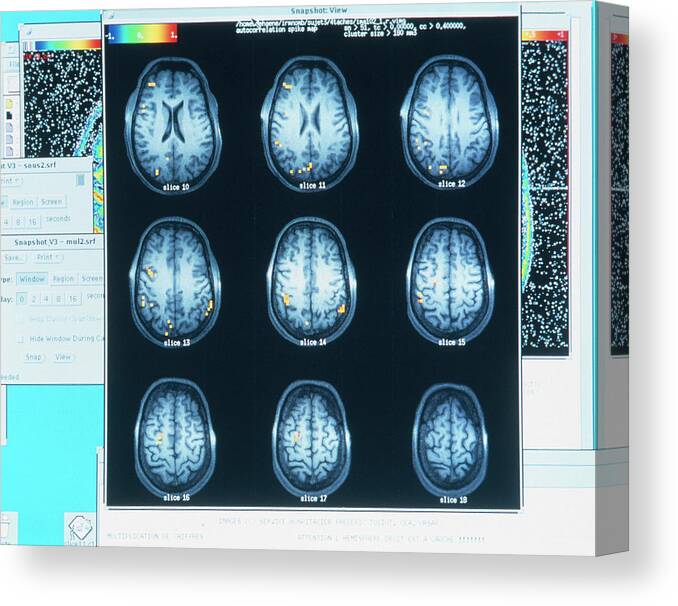 Brain Activity Canvas Print featuring the photograph Eeg Of Brain Activity During Mathematical Thought #2 by Pascal Goetgheluck/science Photo Library