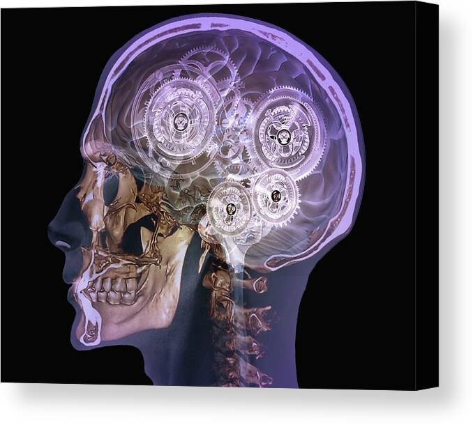 Brain Canvas Print featuring the photograph Mechanical Brain by Zephyr/science Photo Library