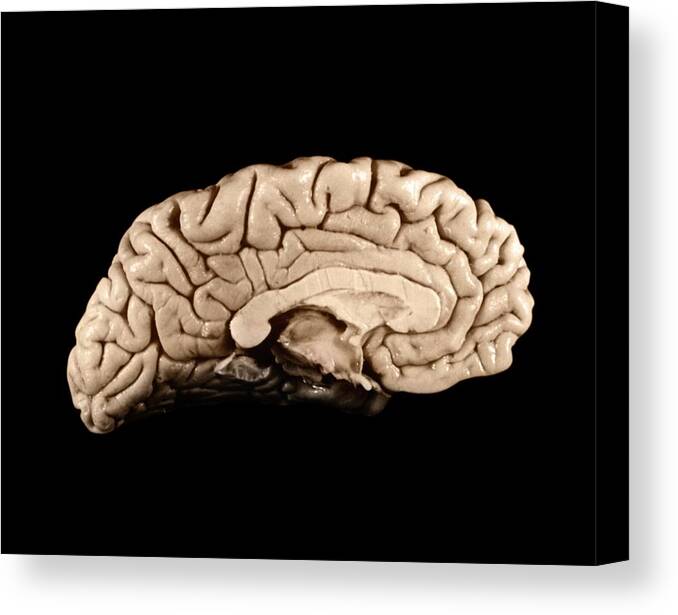 Brain Canvas Print featuring the photograph Einstein's Brain #6 by Otis Historical Archives, National Museum Of Health And Medicine
