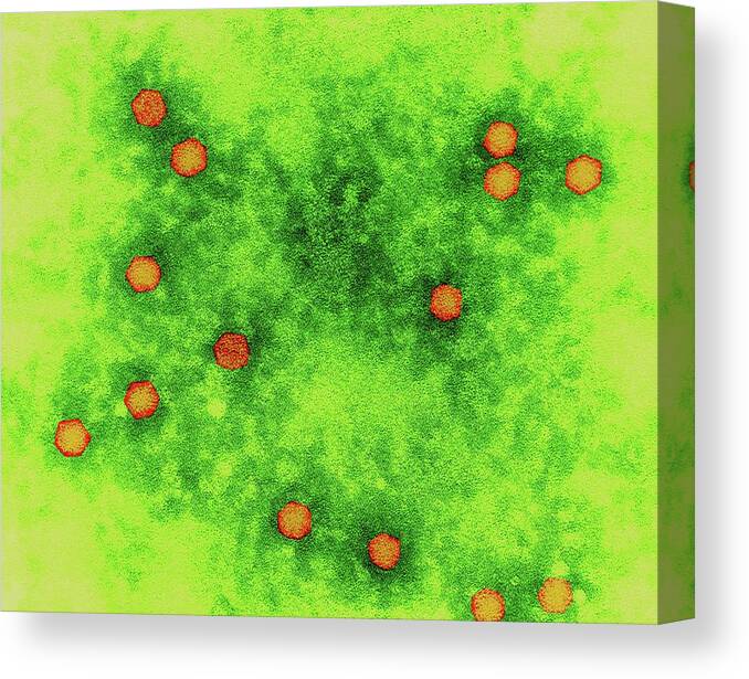 24314a Canvas Print featuring the photograph Polio Virus #7 by Dennis Kunkel Microscopy/science Photo Library