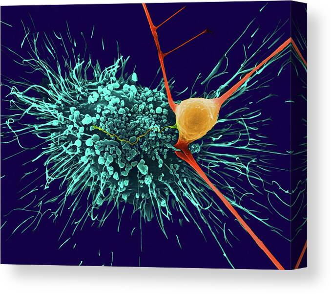 92751a Canvas Print featuring the photograph Astrocytic Glial Cell With Cortical Neuron by Dennis Kunkel Microscopy/science Photo Library