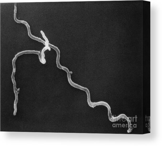 Science Canvas Print featuring the photograph Borrelia Burgdorferi, Sem by David M. Phillips