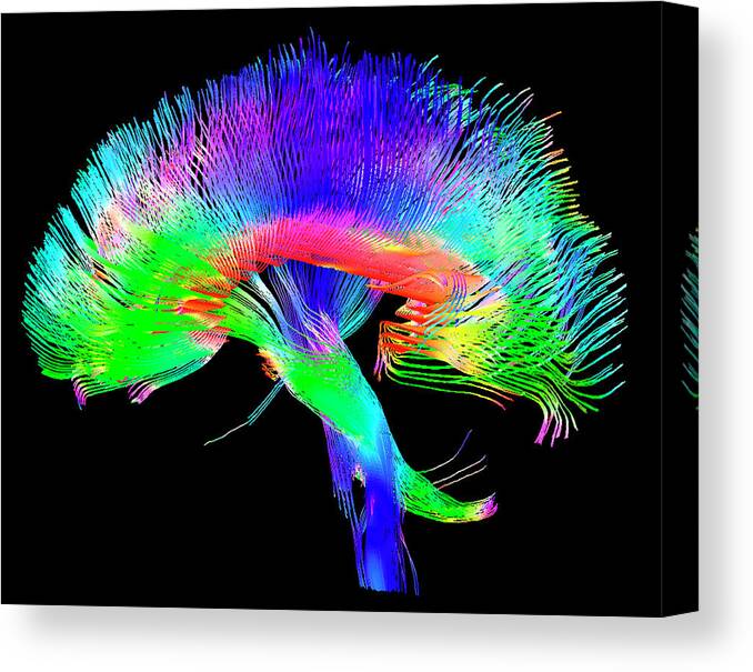 White Matter Canvas Print featuring the photograph Brain Pathways by Tom Barrick, Chris Clark, Sghms