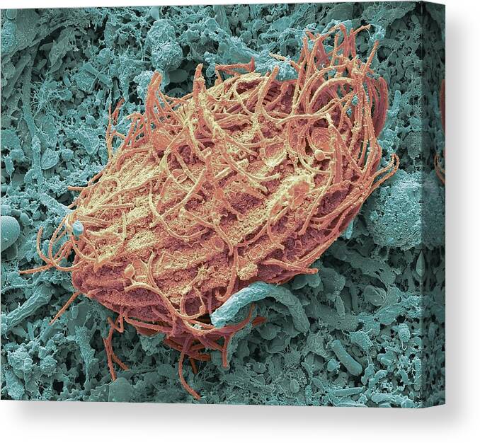 Bacillus Canvas Print featuring the photograph Ciliate Protozoan In Hedgehog Faeces by Steve Gschmeissner